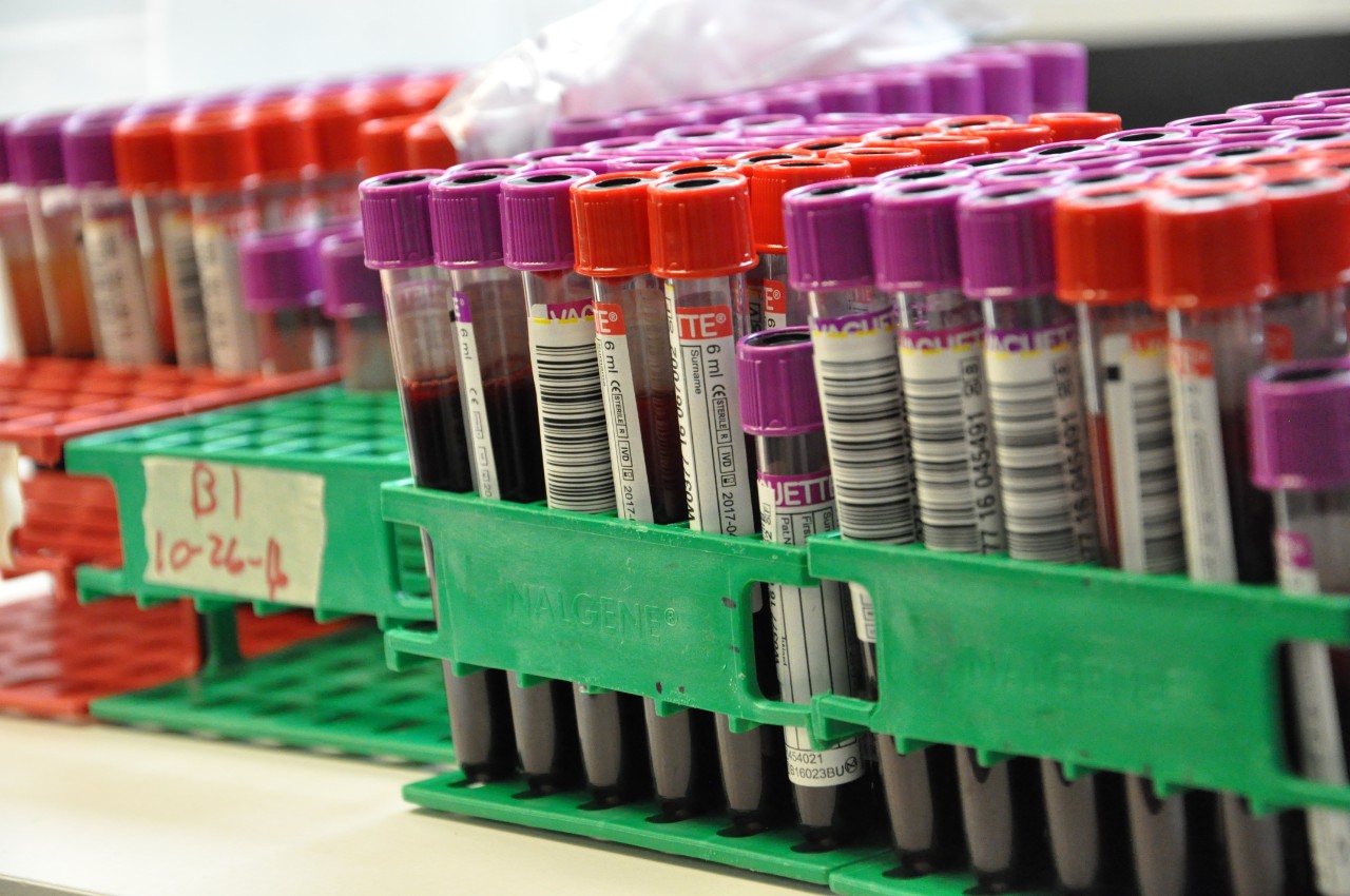 Vials of blood with red and purple tops in racks awaiting testing