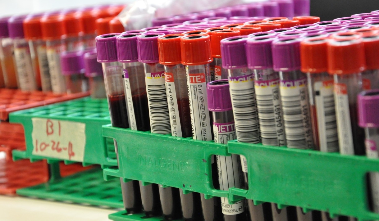 Tubes of blood for testing